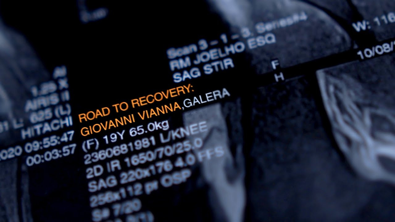 One year and four months on from tearing his ACL, we join a rejuvenated Giovanni Vianna in post-surgery physical therapy in São Paulo, Brazil. Gio talks about skating in the Olympics with only a brace holding his knee together, his plans for the future, and finally getting the chance to film a clip on his pro model board. <br /><br />Filmed and edited by Alan Hannon. <br /><br />Original Music by Nick Andre. <br /><br />Motion Graphics by Blaine Birardi.<br /><br />► Subscribe to Primitive Skate: http://bit.ly/prmtvsub<br /><br /><br />🔥 Follow us:<br />Instagram: http://instagram.com/primitiveskate<br /><br />💰 Shop:<br />http://primitiveskate.com<br /><br />Primitive Skateboarding was established in early 2014 by Paul Rodriguez and Heath Brinkley. Our pros are Paul Rodriguez, Tiago Lemos, Miles Silvas, JB Gillet, Spencer Hamilton, Robert Neal, Marek Zaprazny, Carlos Ribeiro, Brian Peacock, Wade Desarmo, Franky Villani, Giovanni Vianna, and Trent McClung. Ams: Tre Williams, Kyonosuke Yamashita.