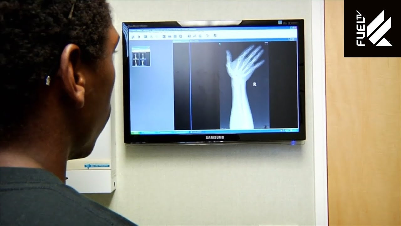 In the Season 2 premiere, James “Bubba” Stewart returns from a rejuvenating summer break, eager to dominate the 2010 Supercross season. After a triumphant win at the Anaheim opener, his momentum is abruptly halted during the second race in Phoenix, where a crash leads to a potentially career-ending injury. The episode delves into the immediate aftermath—medical consultations, travel, and tough decisions—highlighting the challenges James faces as he grapples with the uncertainty of his racing future.<br /><br />🛹 Thanks for subscribing! 🛹 https://youtube.com/@fueltv?sub_confirmation=1<br /><br />Watch more at https://fuel.tv<br /><br />#BubbasWorld #JamesStewart #Motocross #Supercross #TheInjury #FUELTV #Motorsports #BehindTheScenes #RacingLegend