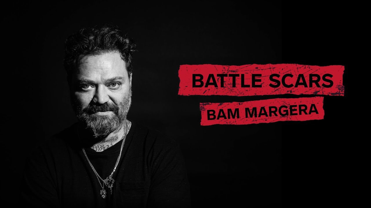 Bam Margera is no stranger to broken bones, he’s broken his elbow alone 15 different times. From all of his stunts in CKY, Jackass, Viva La Bam, skate demos, and countless skate videos, Bam has racked up more than his fair share of Battle Scars. Today, he sits down with us to talk about some of his worst, funniest, and most painful injuries throughout his career. Sit back, (try to) relax, and enjoy Bam reliving his pain for our pleasure in Battle Scars!<br /><br />Limited autographed Bam Margera x Berrics Battle Scars decks are available now in The Canteen!<br /><br />https://canteen.theberrics.com/products/autographed-bam-margera-battle-scars-deck<br /><br />@ThisIsBamMargera hit the scene hard in @ToyMachineskate 's 1998 “Jump Off A Building” followed up with his infamous video series, CKY which led to his starring role in the Jackass franchise on @MTV where he was part of the original Jackass Crew along with Johnny Knoxville, @steveo, Weeman, Chris Pontius and the late Ryan Dunn. Bam went on to have his breakout spin-off show, Viva La Bam which gave him global notoriety and fame. Throughout all of his stunts, film and TV Show appearances, Bam’s skating brought him to the attention of @Elementbrand Skateboards, where he patented his iconic “Heartagram” pro skateboard model, which remains the highest selling skateboard deck in history.<br /><br />Subscribe to The Berrics: http://bit.ly/TheBerricsYoutube<br /><br />The Berrics is the worldwide leader in skateboarding media, founded by professional skateboarders Steve Berra and Eric Koston in December of 2007 that covers skate news, video parts, contests, music, culture, and more. Berra + Eric = Berrics<br /><br />With over 10,000 skateboarding videos under their belt, including Battle at The Berrics, Do A Kickflip and Life on Video, The Berrics is not only one of the most popular online platforms in skate culture but the one of the most famous skate spots in the world. Tune in regularly to watch videos with @TonyHawk @Prod84skate , @nyjah , Yuto Horigome, Rayssa Leal and many more.<br /><br />Subscribe to The Berrics: http://bit.ly/TheBerricsYoutube<br /><br />Daily Videos and More: http://theberrics.com<br />Shop our Online Store: https://canteen.theberrics.com/<br />Follow The Berrics on Instagram: http://instagram.com/berrics<br />Follow The Berrics on TikTok: https://www.tiktok.com/@berrics?<br />Follow The Berrics on Facebook: http://fb.com/berrics<br />Follow The Berrics on Twitter: http://twitter.com/berrics<br /><br />#Skateboarding #Berrics #TheBerrics #SkateboardingIsFun