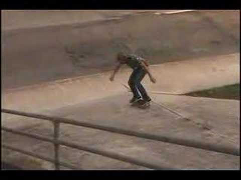 Please keep Grant in your thoughts and prayers. While skateboarding, he was unfortunately hit by a truck, and after undergoing 3 surgeries, we have been told that he will never walk again. He has been in a coma for the past 36 hours. Please hope for him to pull through.