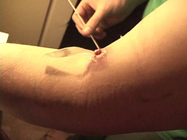 Let this be a cautionary tale to you children out there, don't be like us. If a spider crawls on your arm while you are using an exacto knife to handcut NEW HELL DVD cases, please drop the knife before you try to strike the spider off. Also, if in which case you do get lacerated....for the love of god, please try to keep the wound clean so it doesn't get infected.<br /><br /> Big is not a role model!