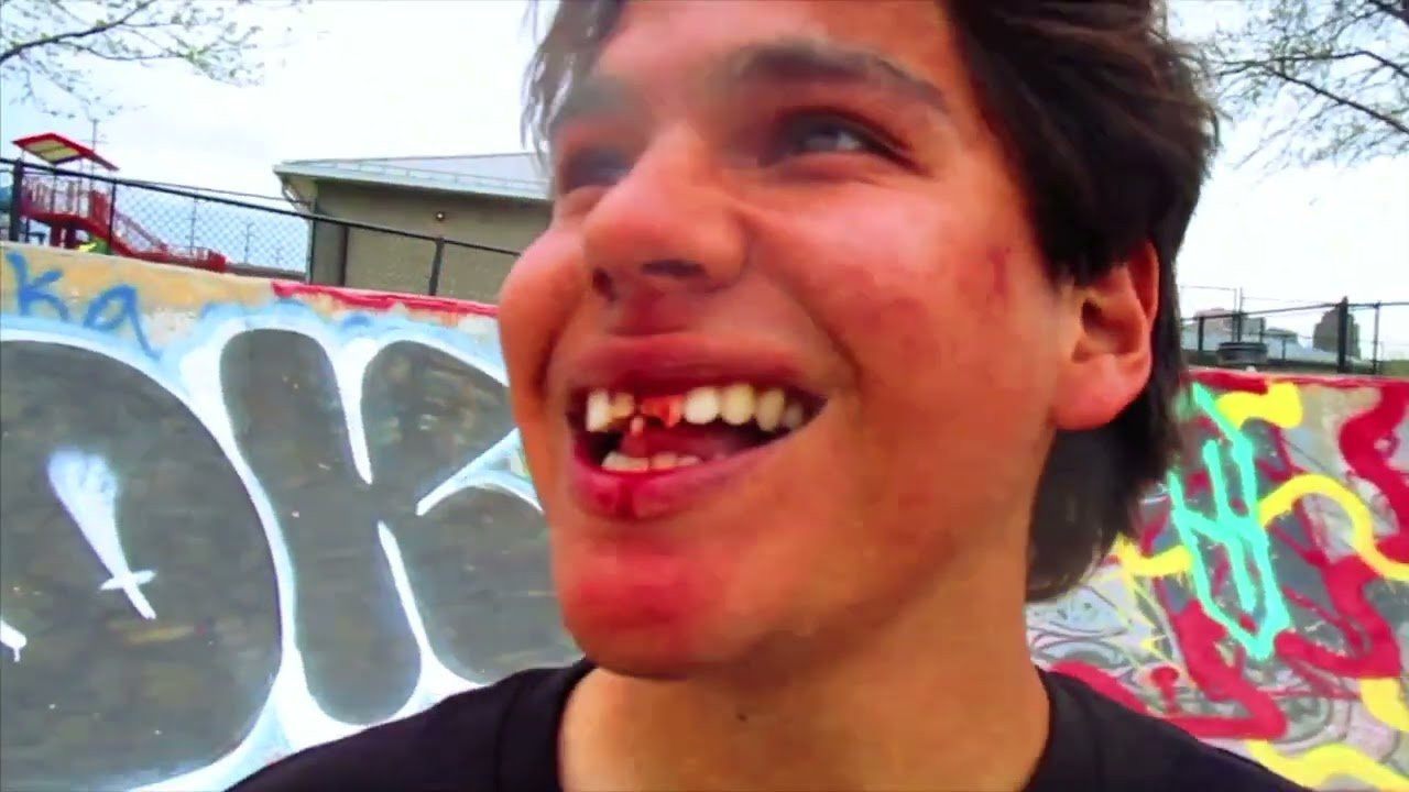 filmed by Daniel Dent, Shari White, Chris Ramos, Chris Milic, Grant Yansura, Kei Tsuruta, Alex Greenberg, Ryan Mettz, Eli Awbry, Marky Numbers, Jonathan Flechas, Matt Schmidt and Sarah <br /><br /><br />https://frogskateboards.com/