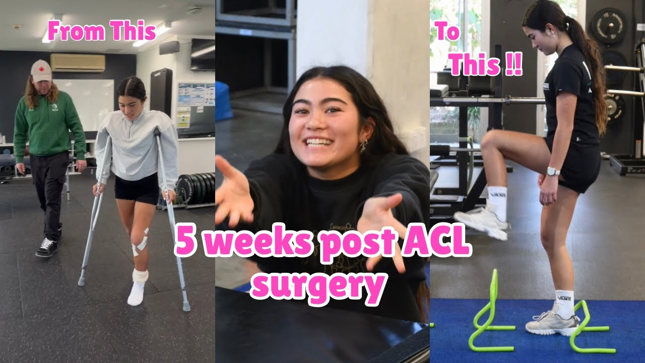 5 weeks post ACL surgery. Lots of rehab, recovery and gym 💪💗<br />It’s now been 3 months from my original injury and 2 1/2 months since my surgery but this video shows what 5 weeks post operation looks like ✨<br />Hope you enjoy :) 💕💕<br /><br />Thank you to everyone who has been there for during this process and to @nickreessportsphysio @_lnperformance @skate.australia @qldacademysport @theais_ @surfingaushpc <br />Thank you @trekashmore @trekbikes 🚲<br /><br />🎥 @trewphotography